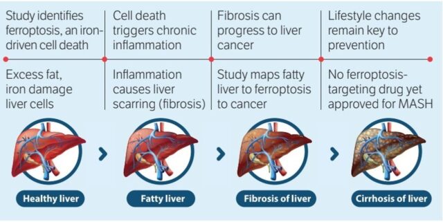 Kashmir scientist sheds new light on fatty liver-cancer link Kashmir scientist sheds new light on fatty liver-cancer link
